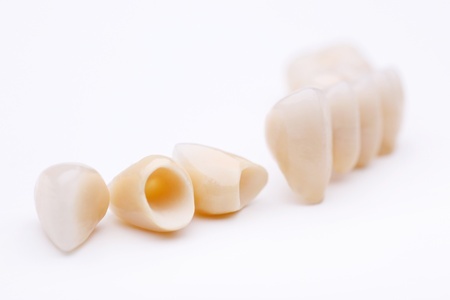 All Porcelain Crowns