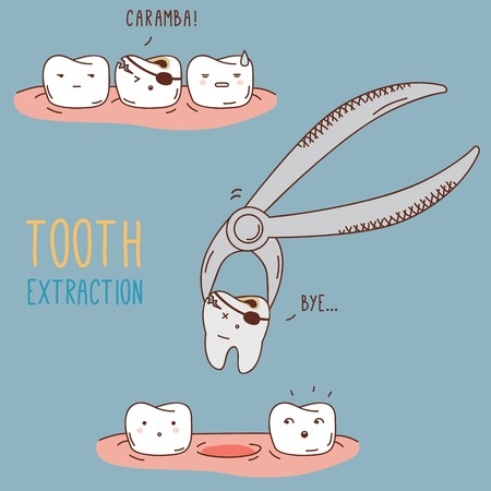 Extractions